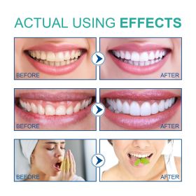 Coconut Oil Mouthwash (Quantity: 1PCS)